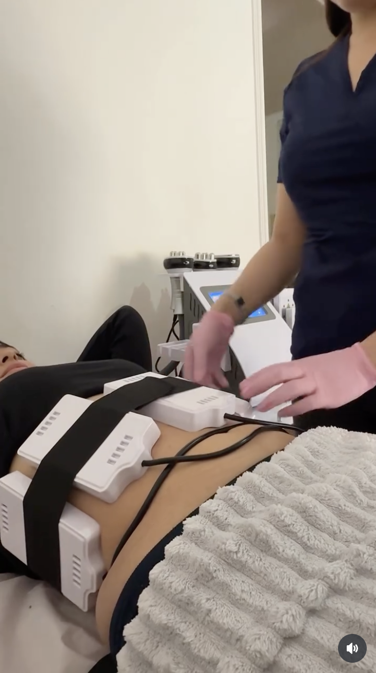 Lipoláser no invasivo Santiago tratamiento